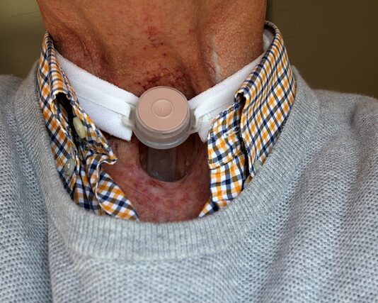 Jak żyć po tracheotomii?