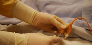 Czy do każdej operacji zakładany jest cewnik?