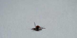 Jak pozbyć się limfy z nóg?