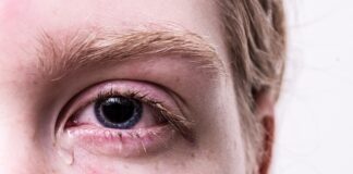 Dlaczego robi się siniaki po pobraniu krwi?