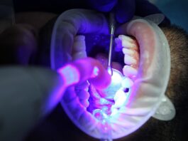 Po co się wybiela odbyt?